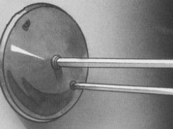 Fig 5